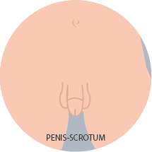 Penis - Scrotum