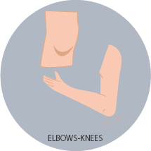 Elbows - Knees