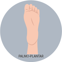 Palmo - Plantar